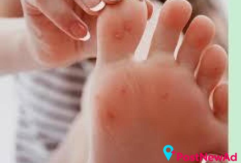 Flat Foot Therapy South Amboy