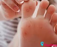 Flat Foot Therapy South Amboy