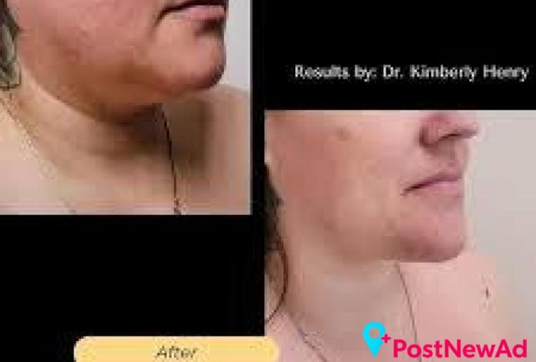 Breast Plastic Surgery Greenbrae